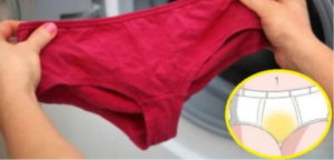 Why Do Yellow Stains Remain on the Crotch of Your Underwear After Washing?